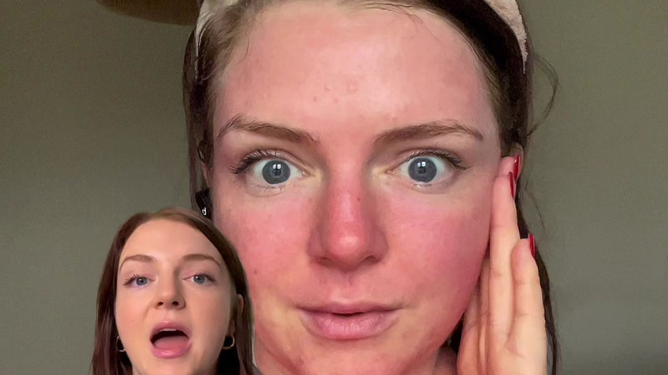 Does your face go red after a face mask? - DeepSandSkin